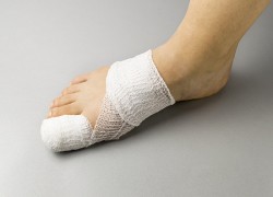 Вросший ноготь: профилактика и лечение