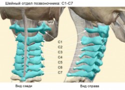 Корешковый синдром: симптомы и лечение