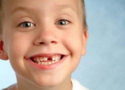 Дети теряют память вместе с зубами