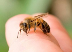 Укусила пчела: первая помощь 